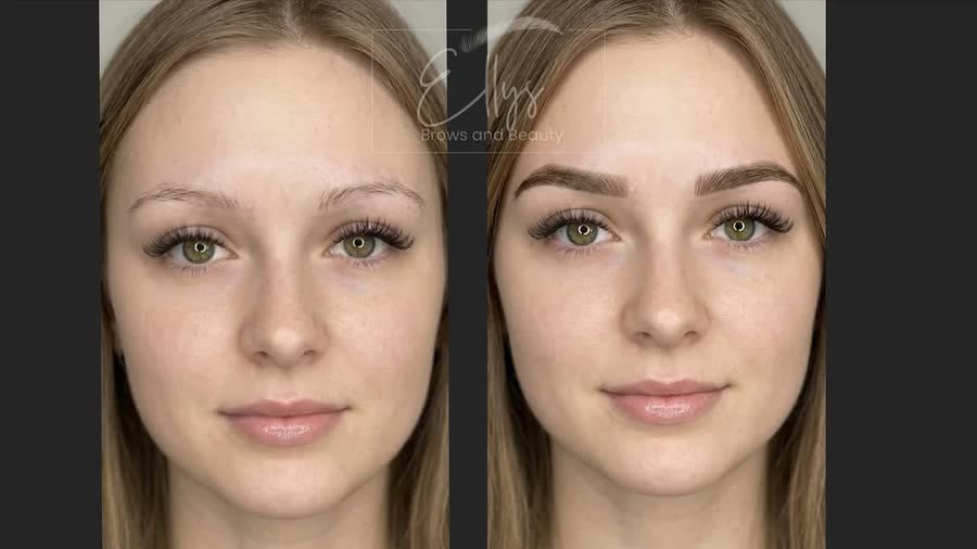 Brows — before & after result
