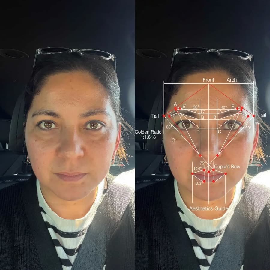 Golden-ratio brow mapping