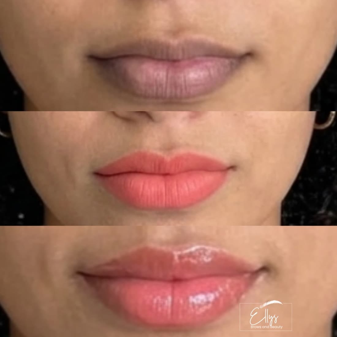 Lip Neutralization