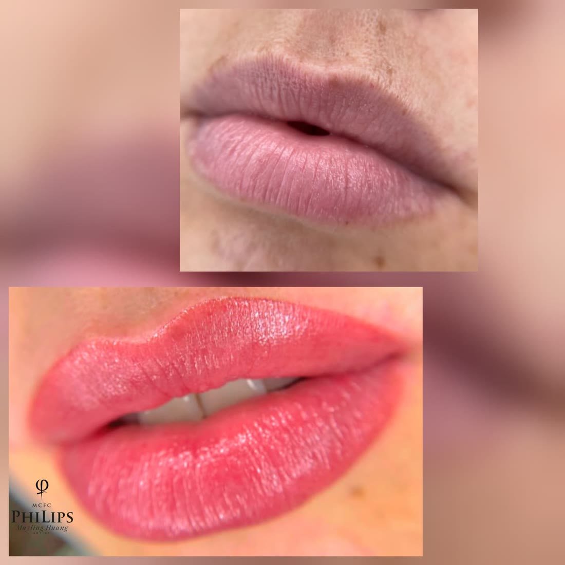 Lips